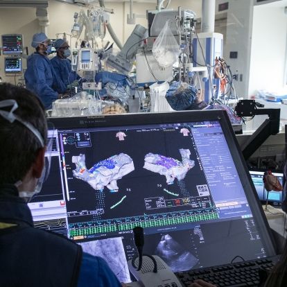 heart mapping