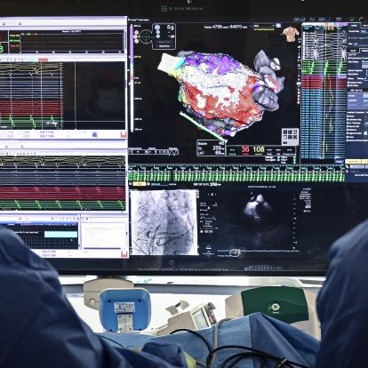 heart mapping