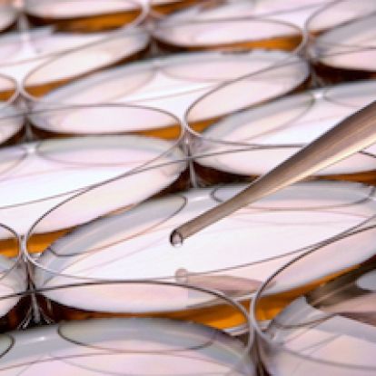 Petri dishes