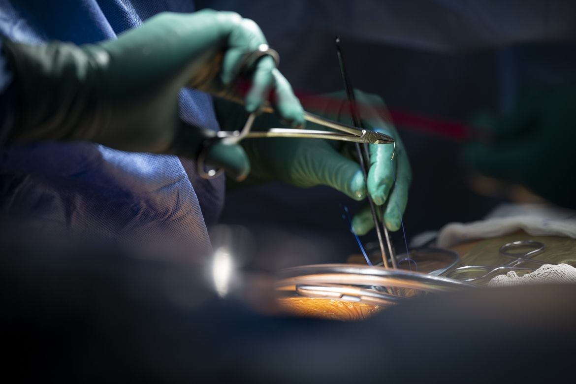 cardiac surgery