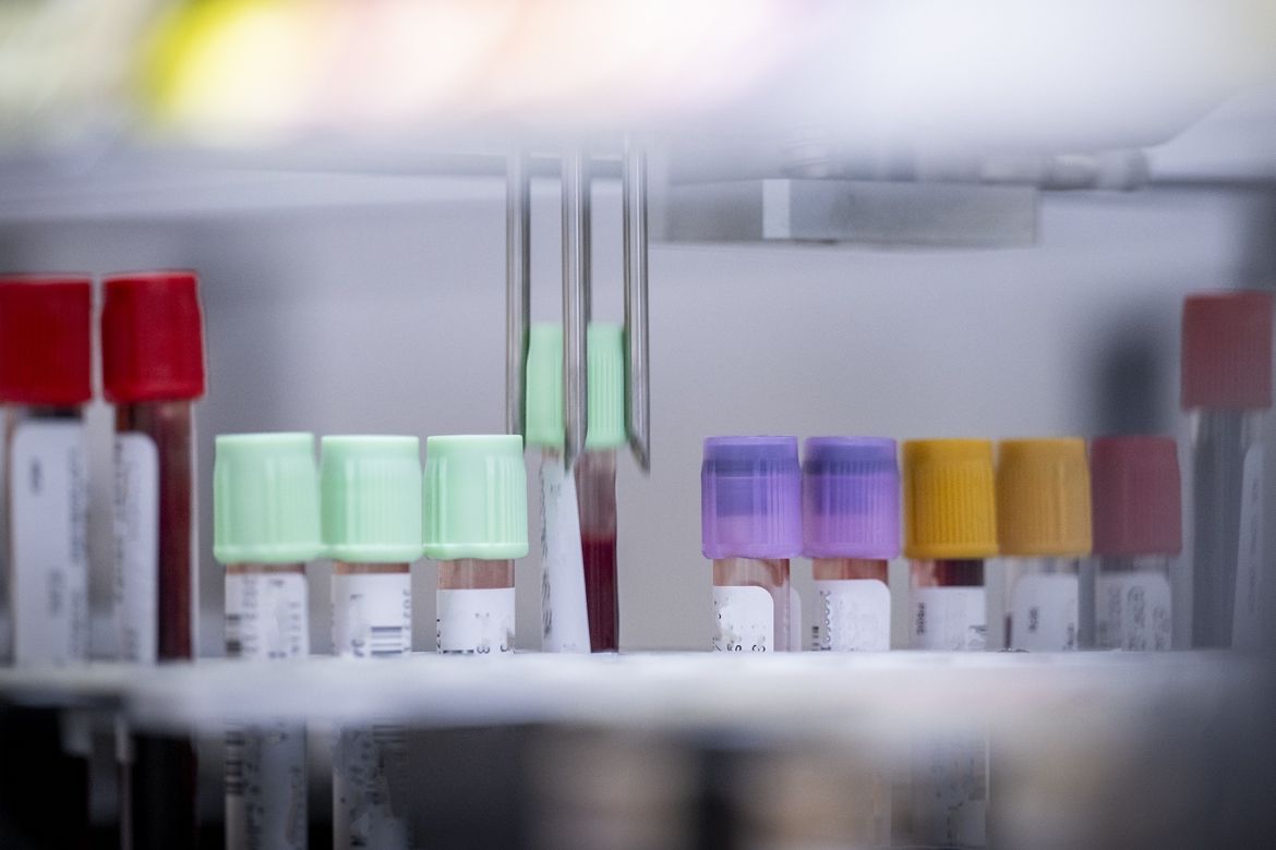 KHSC's laboratory robotics testing a series of blood vials.