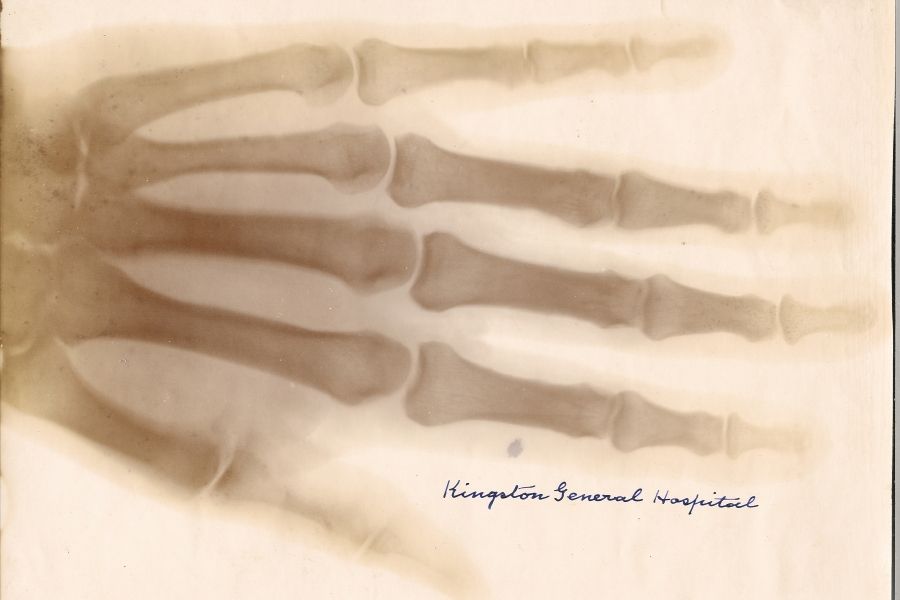 X-Ray Print (1896)