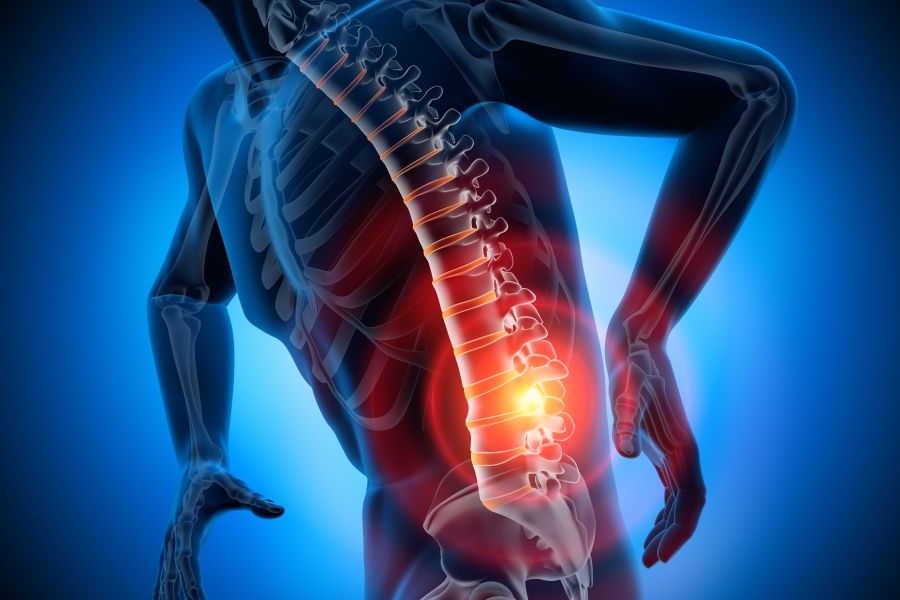 back pain graphic
